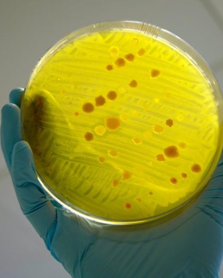 Une étude norvégienne révèle comment les eaux usées des hôpitaux propagent la résistance aux antimicrobiens 8 Une étude norvégienne révèle comment les eaux usées des hôpitaux propagent la résistance aux antimicrobiens - 7