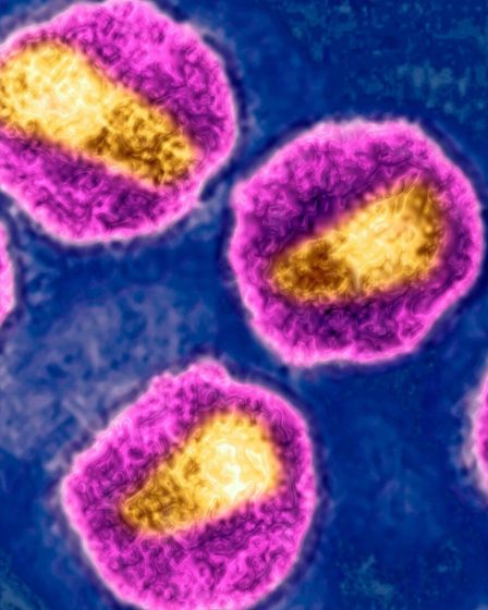 Un Norvégien guéri du VIH grâce aux cellules souches de son frère 2 Un Norvégien guéri du VIH grâce aux cellules souches de son frère - 1